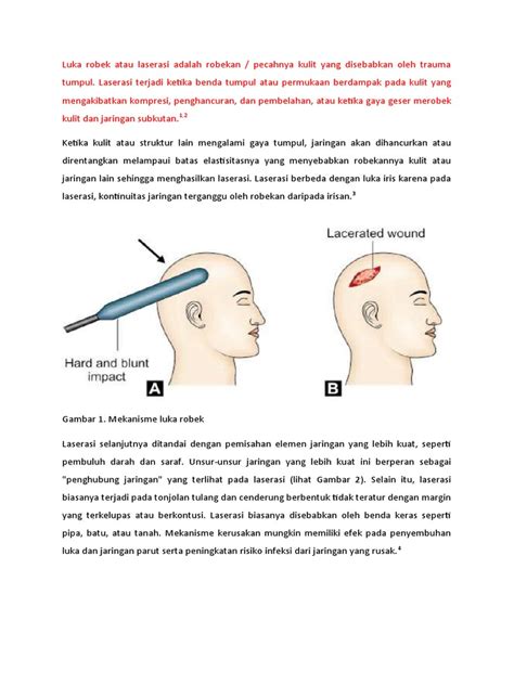 WwW xhHamMster ViDeOs musik penyembuhan stroke model robek setelah pit stop ultra link bokep indonesia terbaru image 5